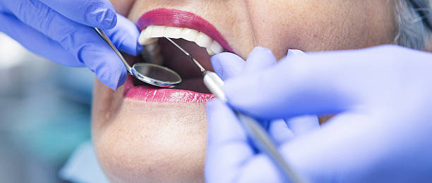 Best Emergency Treatment for Oral Infections in Norwich, NY